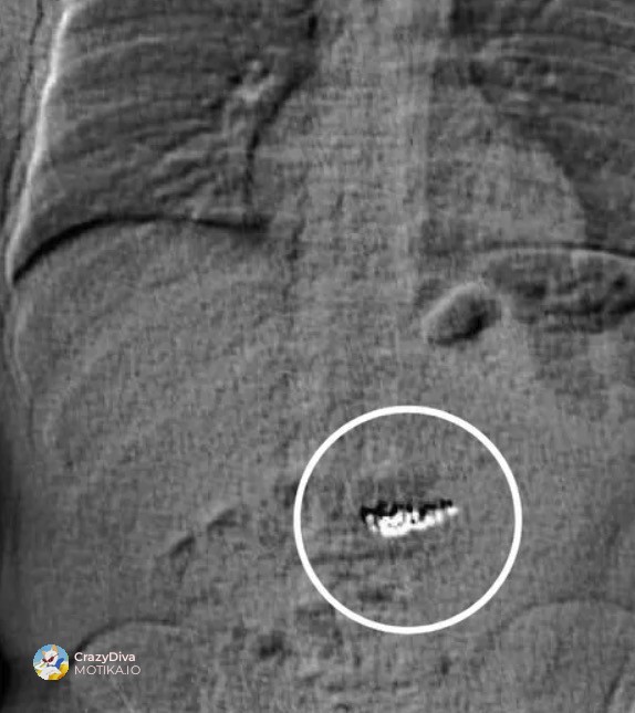Мора накитот да поминет низ системот на Гилдер