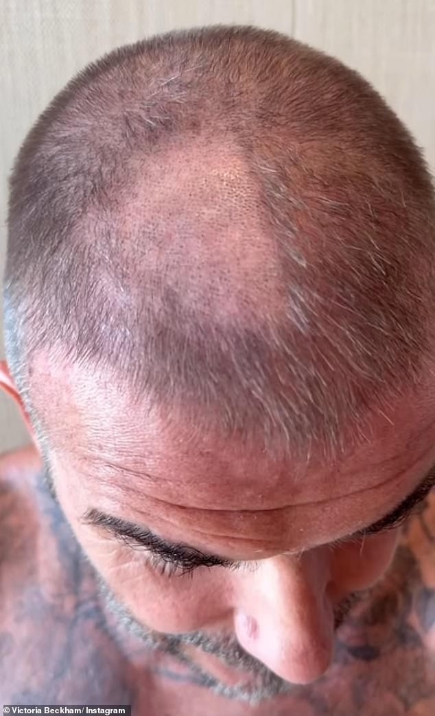 Дејвид Бекам остана со видлива ќелава дамка по неуспешно сопствено шишање – дури и Викторија призна: „Изгледа ужасно“