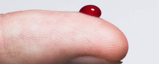 Изгледа сепак теориите на заговор за богаташите биле точни: Младата крв навистина подмладува – научниците го докажаа ова во човечки клетки на кожа