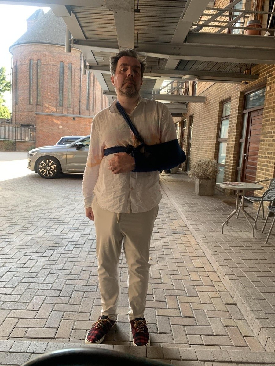 Светската слава го натера да заврши во болница: Мажот со најголем „алат“ на светот се повреди поради сопствениот орган