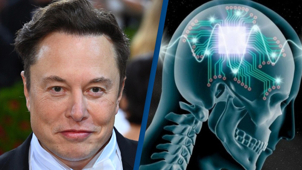 Мозочниот чип од Neuralink – моќта да го промениш својот ум, но и својата иднина