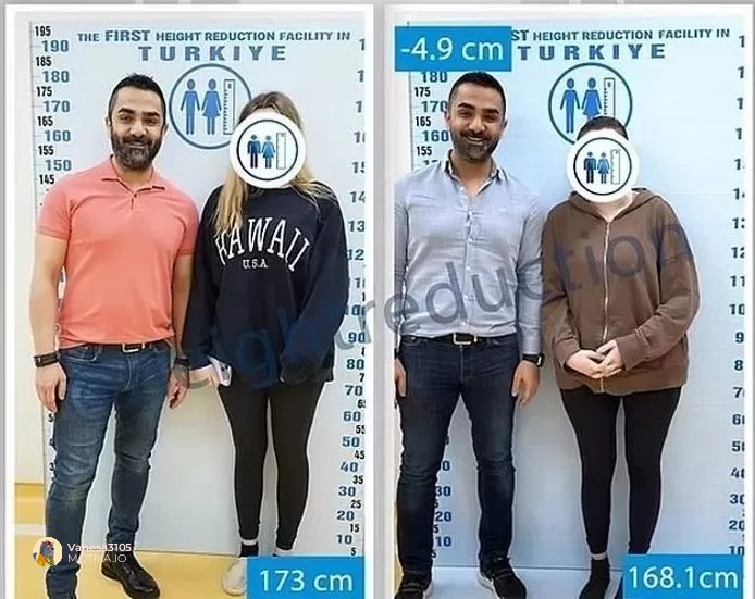 Од медицинско чудо до козметичка опсесија