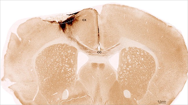 Células madre: la primera pista real para reconstruir un cerebro dañado por ictus