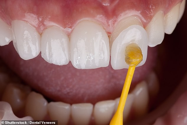 Le sourire: la chose la plus importante du visage selon un dentiste des célébrités