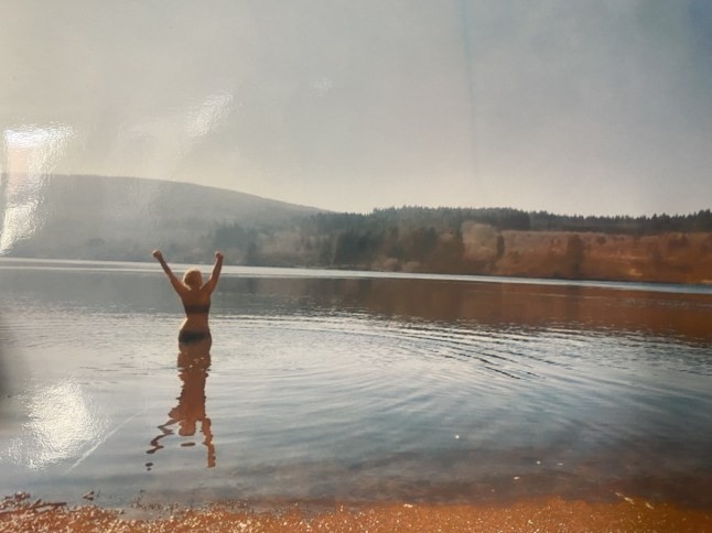 Симптомите на сепса – кои никогаш не треба да ги игнорирате