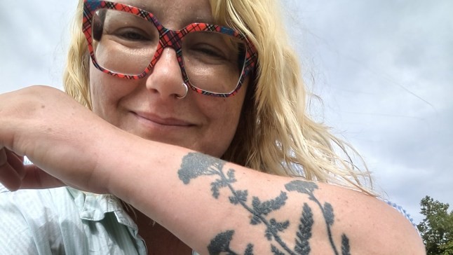 I’ve survived deadly sepsis six times — one symptom always raises the alarm