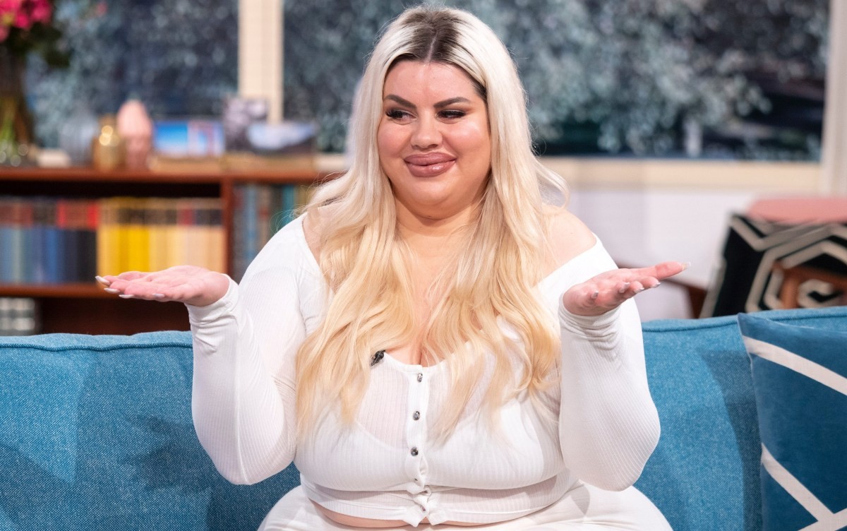 Потрошив 145.000 долари на естетски операции - еве како изгледав порано