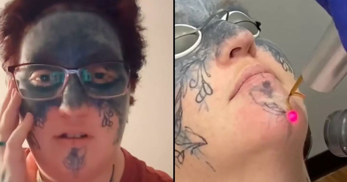 Шокантна исповед на жената на која присилно ѝ било истетовирано лицето:  Водев долга и болна борба да ги отстранам тетоважите, а еве како изгледам по две години мачење