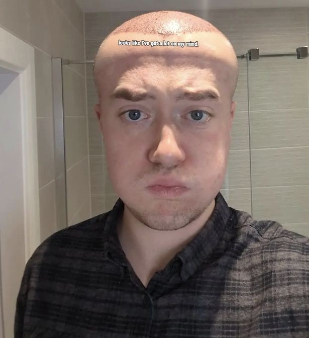 A recuperação brutal e o efeito visual na cabeça