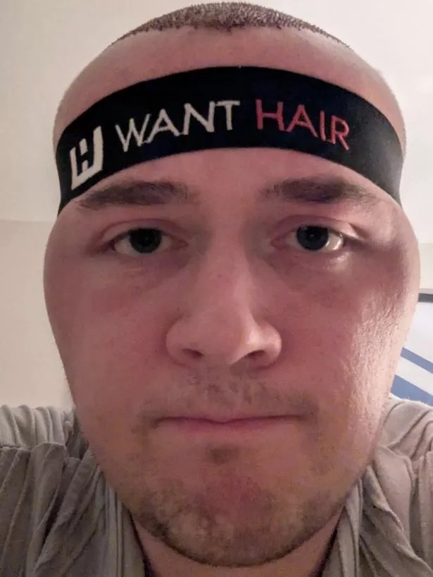 Chęć powrotu do wieku i decyzja o transplantacji