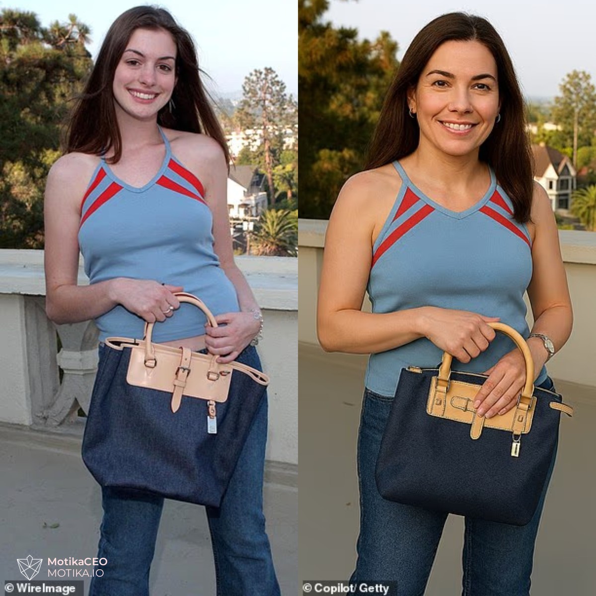 Ен Хатавеј призна дека сакала операција на носот, но подоцна ја прифати својата уникатност