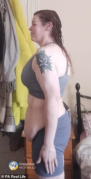 Лицето на огромен успех: Отстранување на вишок кожа по масивно слабеење и нова животна цел