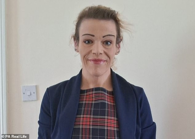 Mujer de 31 años revela cómo perdió 86 kg sin usar inyecciones para grasa y lo logró en poco más de un año