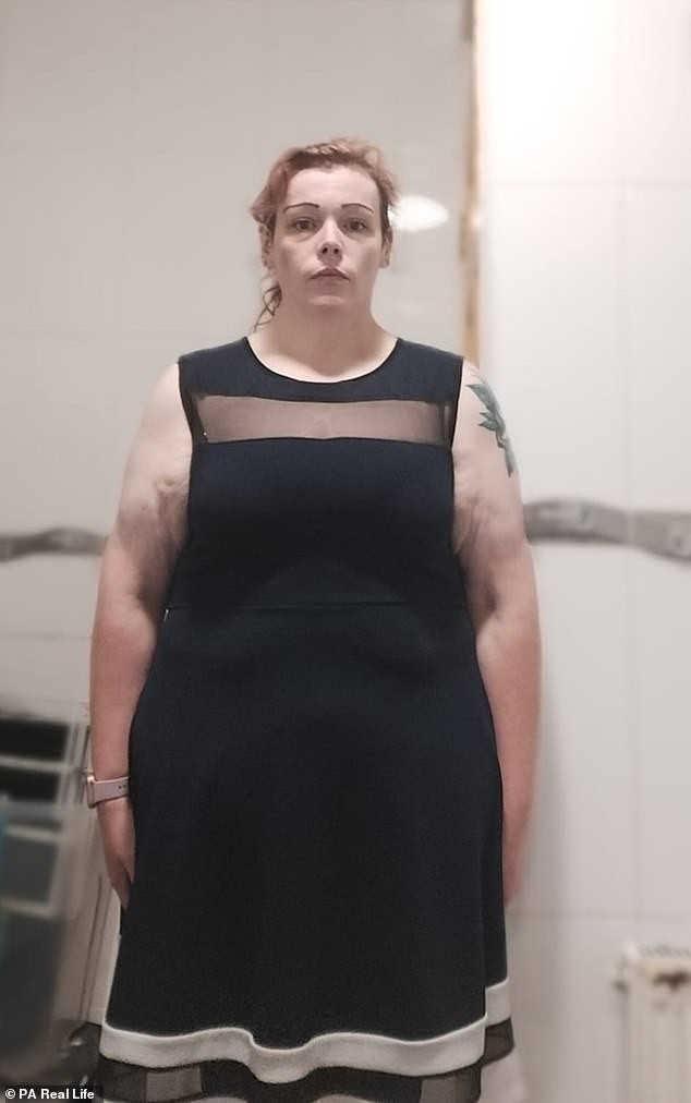 Infância marcada pelo bullying e o ciclo de comer as próprias emoções que a levou aos 140 kg