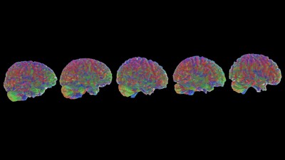 El cerebro humano tiene cinco edades y cada una llega con cambios profundos