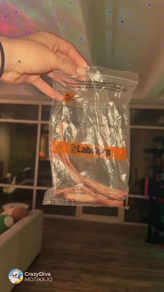 Новиот хируршки хит се шири – жени од 20 до 60 години бараат ремоделирање на ребрата