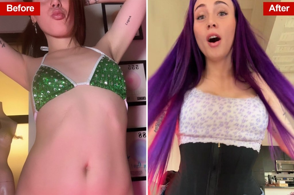 Jovens mulheres gastam milhares para remover costelas em busca do corpo Ozempic