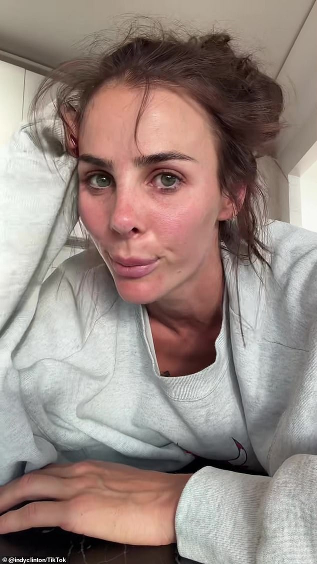 Indy Clinton Demands Fans Pay to See Her Repaired Nose After Botched Rhinoplasty