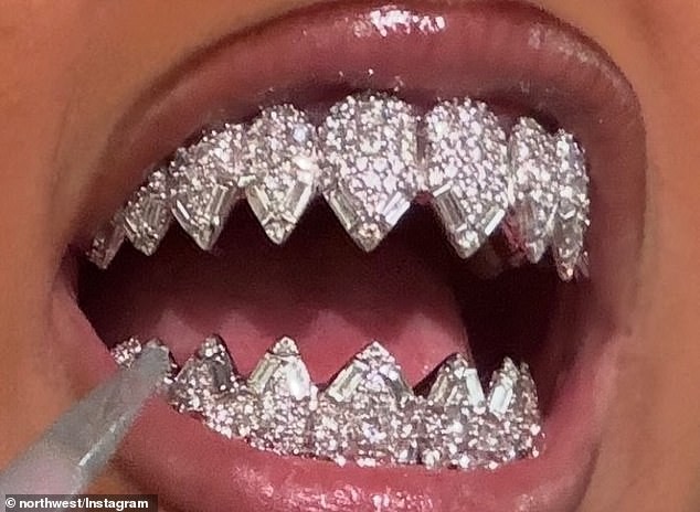 North West exhibe son grill en diamant en forme de dents de requin signé par un joaillier célèbre et approche du million de likes