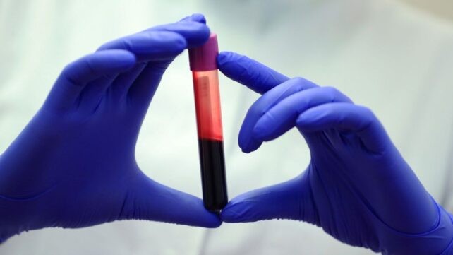 O sangue dos superlongevos revela segredos que podem nos fazer viver mais