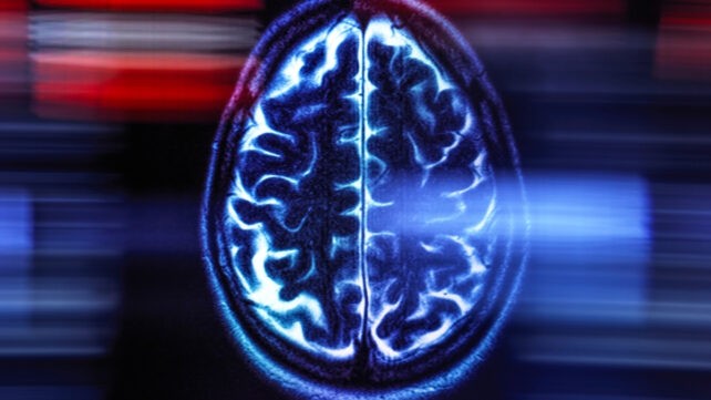 Откриена едноставна навика што го намалува ризикот од деменција речиси напола – и зошто токму сега тоа е алармантна порака