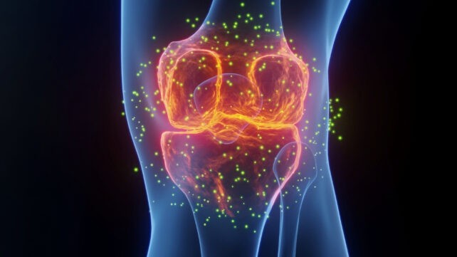 La mejor medicina para el dolor articular no es lo que piensas