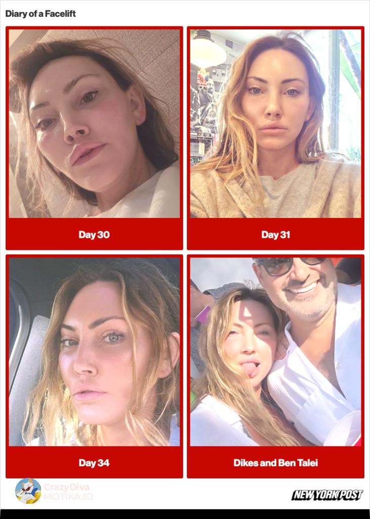 Патот на закрепнување: Пет дена после операција можеше да работи, резултатите полека се разоткриваат