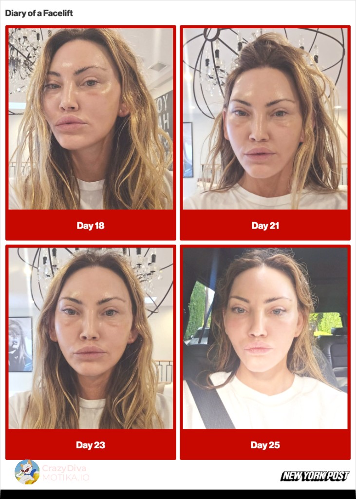 Седум и пол часа под нож: Денот на операцијата и носењето на јавноста во приказната