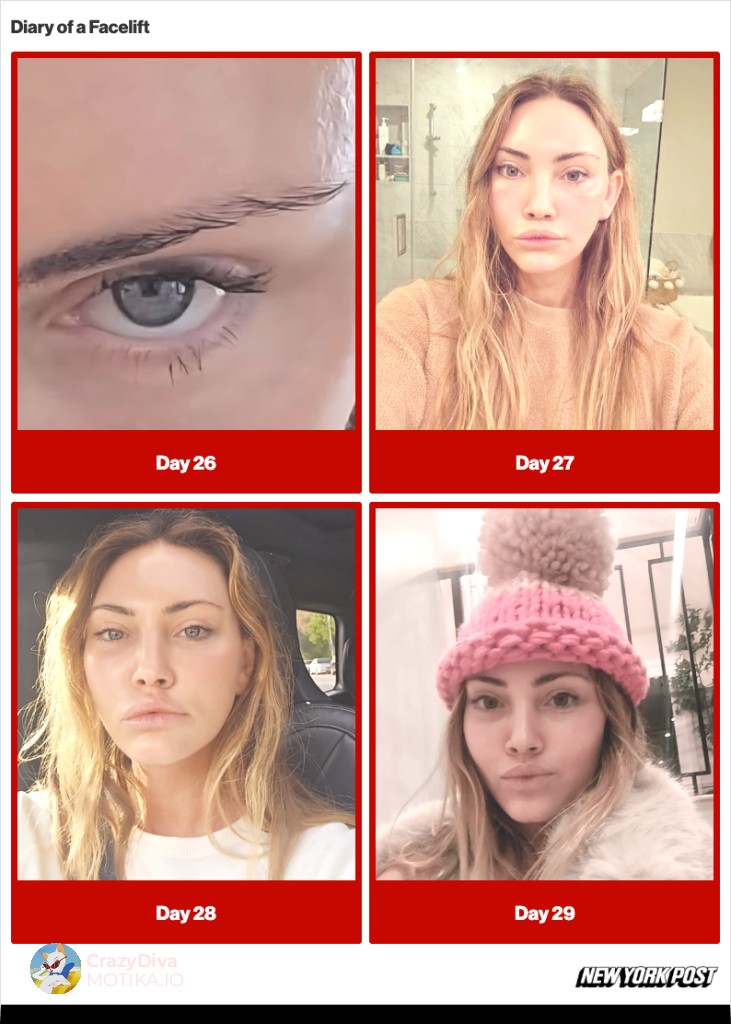 Стравот од сопствениот одраз: Подготвена за најлошото и изненадена од шокантниот изглед веднаш после операција