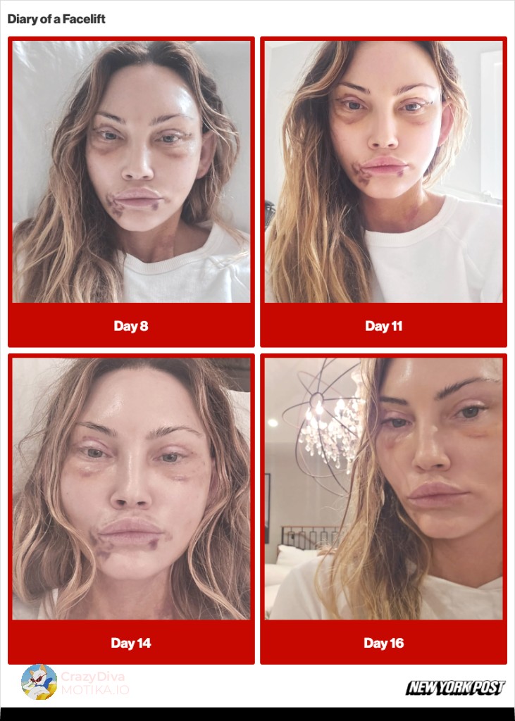 „Стареењето стана очигледно“: Како докторот ја оцени вистинската состојба на лицето на Триша