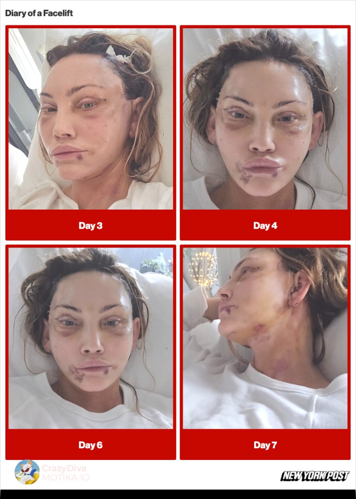 Подготвена за најекстремна промена: Зошто Дајкс го избра хируршкиот зафат и што ја очекуваше