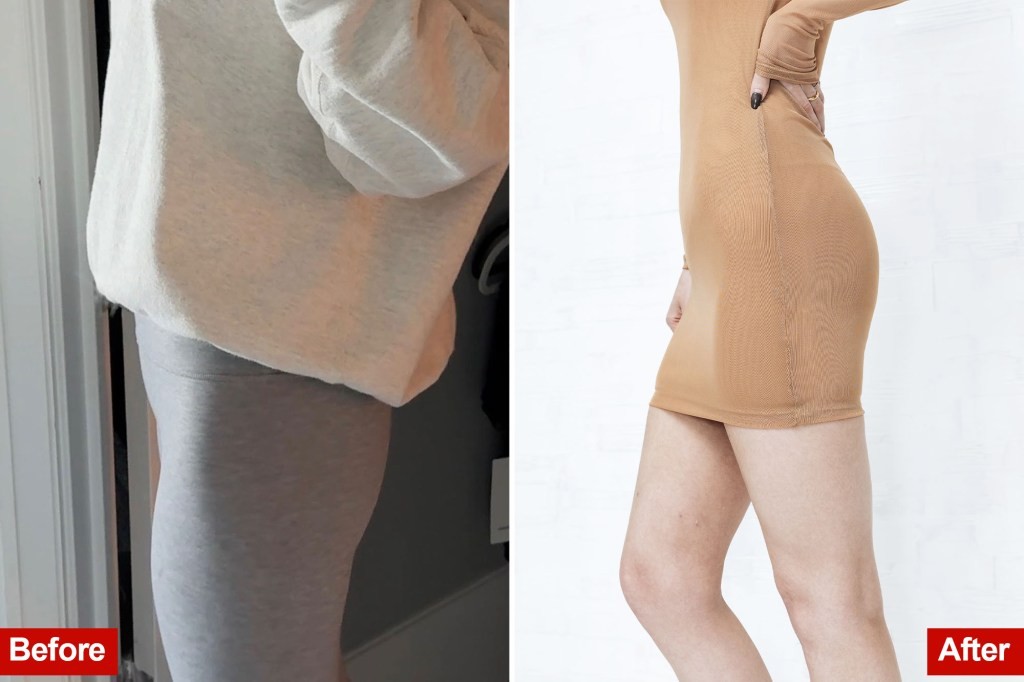 Рециклирана убавина: Жени си ги зголемуваат задниците и градите со маст од починати лица и тврдат дека си ја враќаат самодовербата