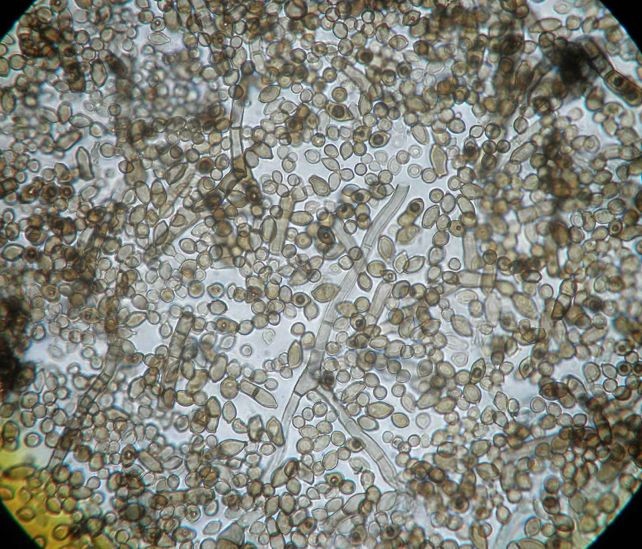 Црната мувла во Чернобил се храни со смртоносната радијација - преживува таму каде што човекот не смее ни да се приближи