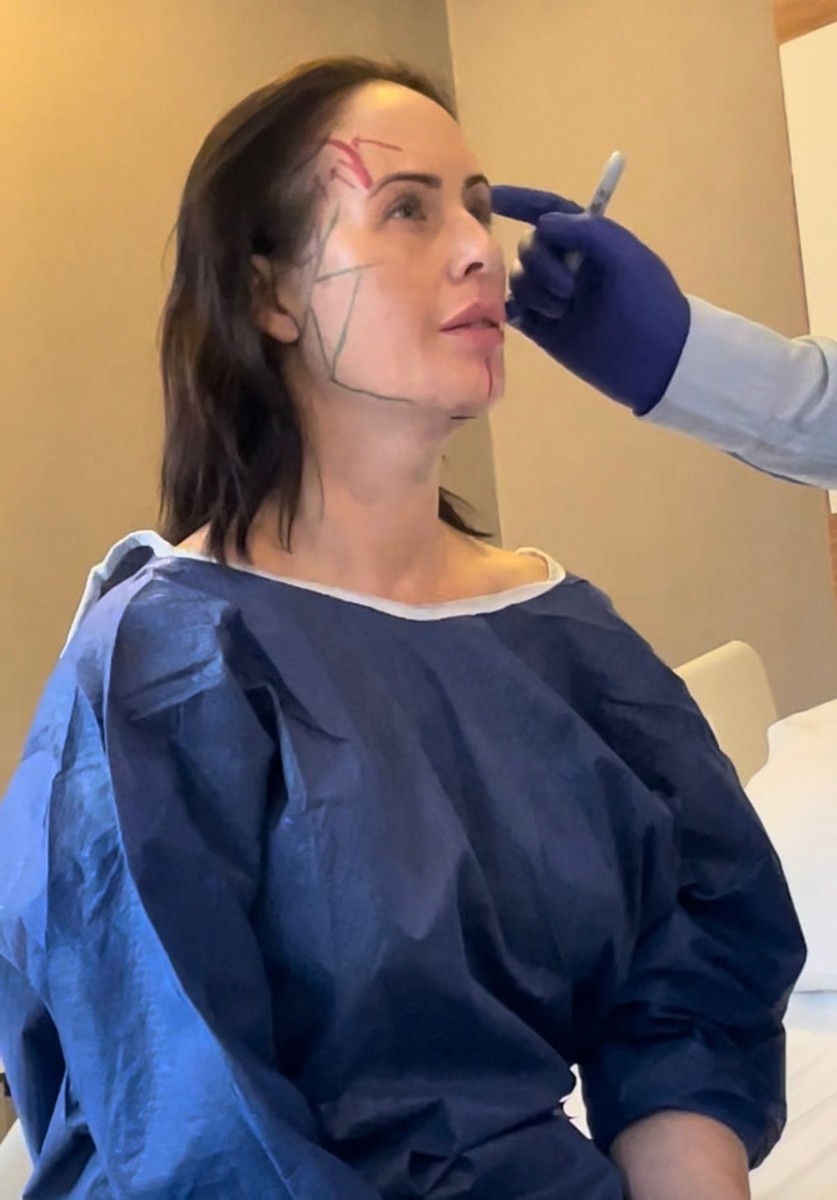 Потрошени 12.000 евра и 19 часа во авион за лифтинг, а троловите велат дека изгледа постаро од кога било