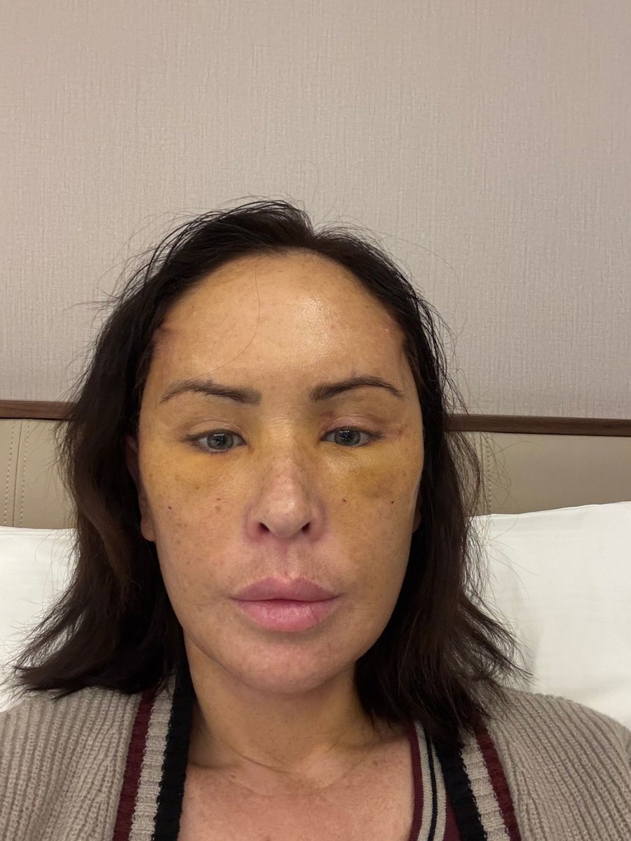 Џоџо по операцијата: „Луѓето мислат дека сакаш да станеш друга личност, но јас само сакав да бидам себеси“