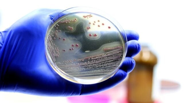 Candesartan cilexetil ја оневозможува MRSA преку пробивање на клеточната мембрана на бактеријата