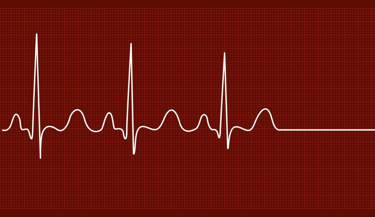 Може ли човек да ја види сопствената смрт? Необичен медицински случај ги остави лекарите во шок и неверување